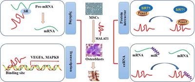 The regulatory activities of MALAT1 in the development of bone and cartilage diseases